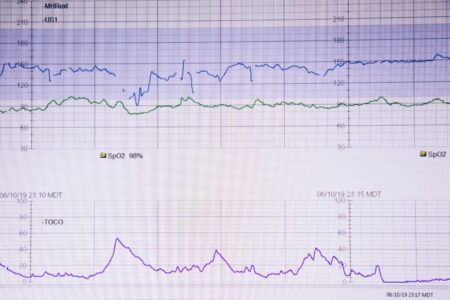 Ответы на “планы родов” роддома № 5 Минска, наши комментарии и рекомендации о правах в родах